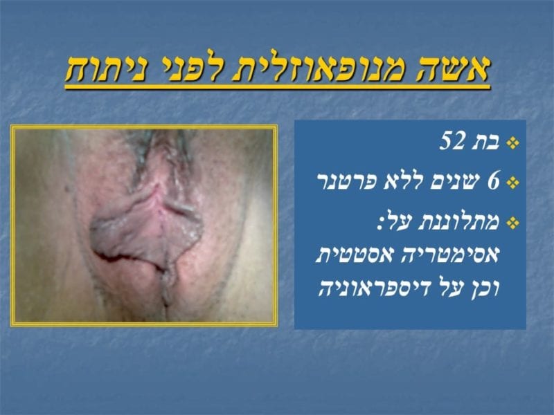 מצגת כירורגיה פלסטית של הנרתיק והפות (10)