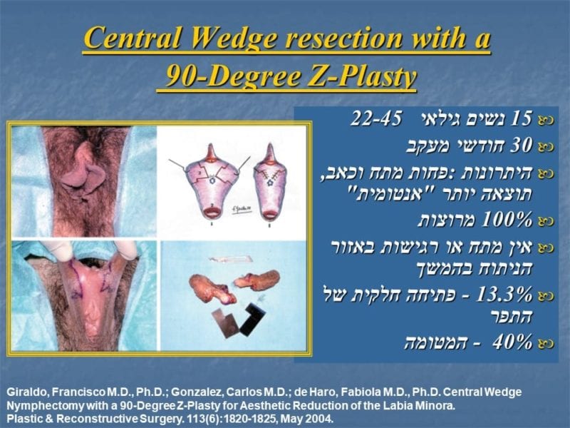 מצגת כירורגיה פלסטית של הנרתיק והפות (32)