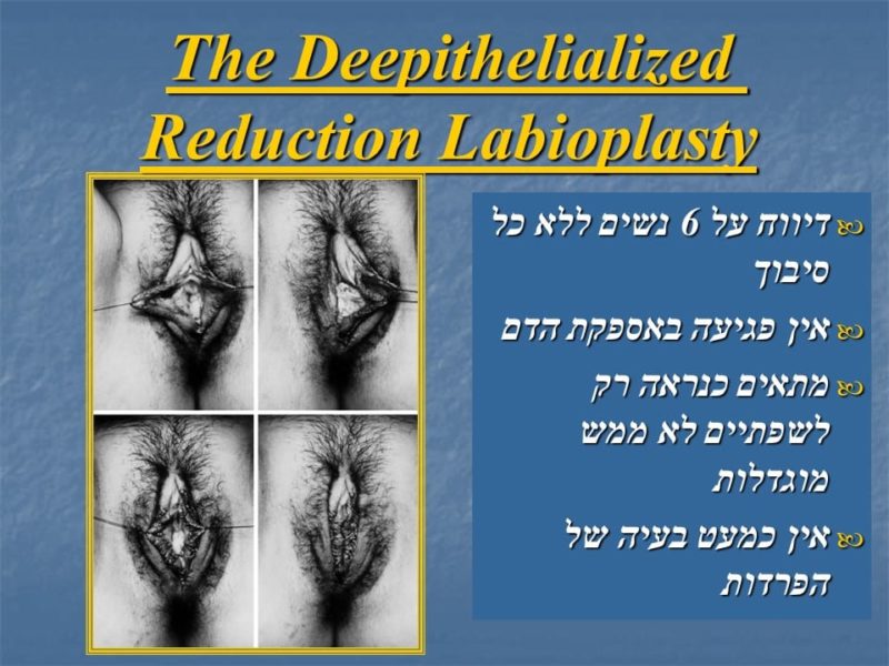 מצגת כירורגיה פלסטית של הנרתיק והפות (34)