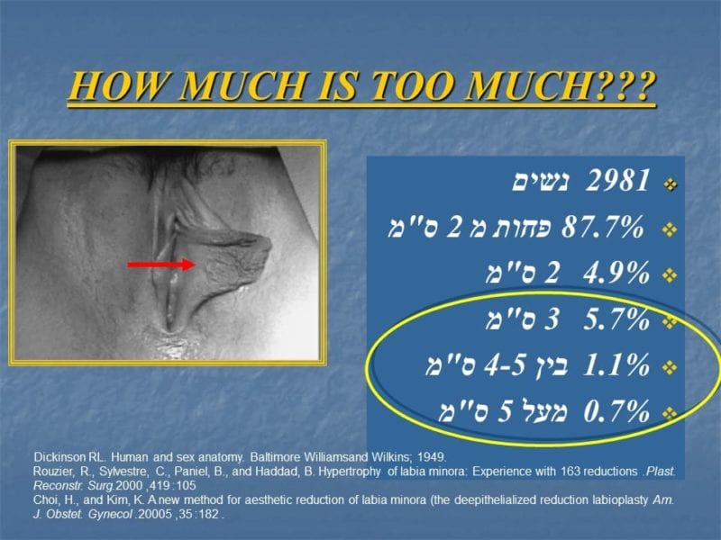 מצגת כירורגיה פלסטית של הנרתיק והפות (4)