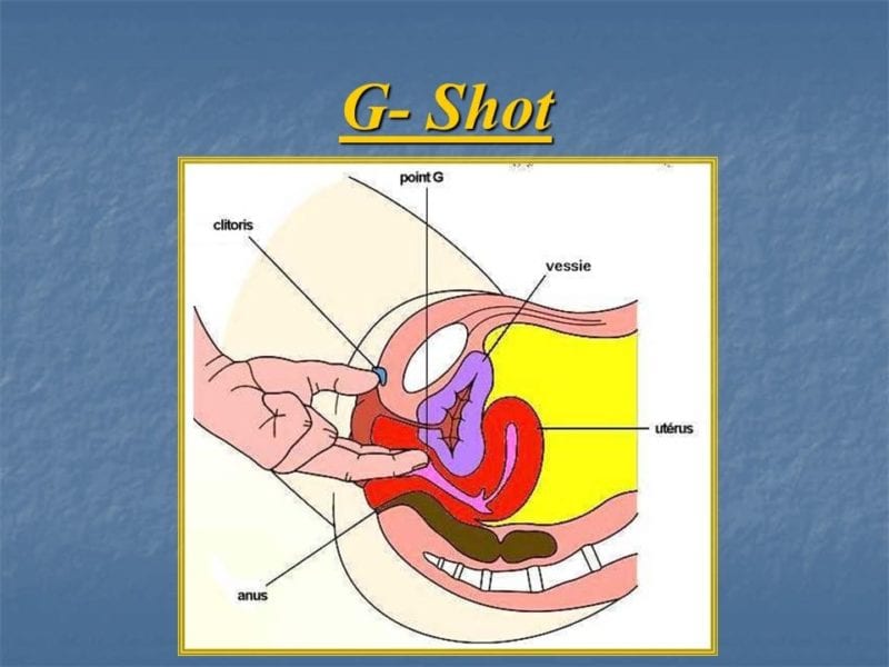 מצגת כירורגיה פלסטית של הנרתיק והפות (50)