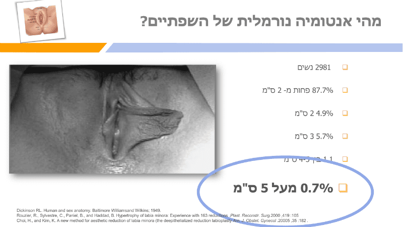 מצגת תיקון שפתי הפות (8)