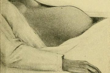 אפיזיוטומיה – חיתוך חיץ הנקבים